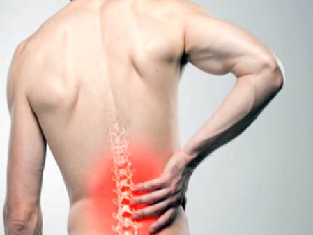 Slip Disc Symptoms: Common Back Pain Could Be a Warning Sign