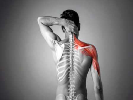 Calcium Vitamin D Combo Boosts Spine and Joint Health