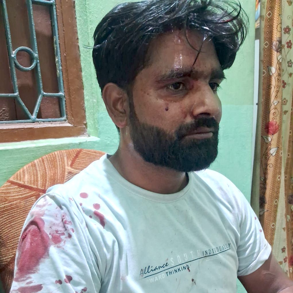 Liquor Mafia Attack: Youth Brutally Beaten for Opposing Illegal Alcohol Trade